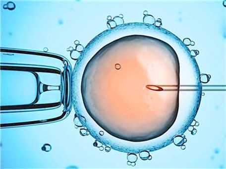 胎儿输卵管狭窄~一代试管和二代试管的区别顺产
