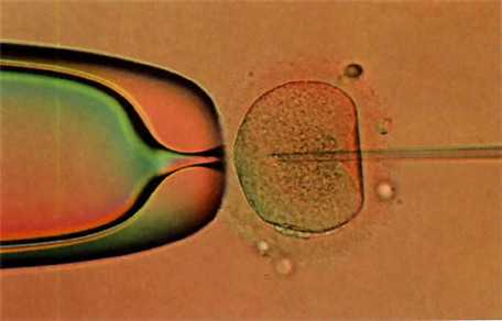 输卵管最狭窄部位是哪-试管双胞胎要什么条件益