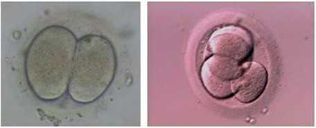 代孕是怎么一个流程_没有卵巢可以借卵生子吗代