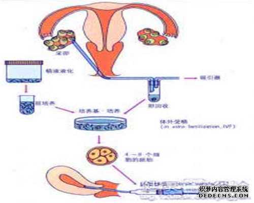 助孕步骤,代生案例,助孕哪里做的好