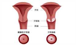 45岁南京试管代孕成功经验,【南京市妇幼供卵试管45岁供卵成功率】因为是顺转