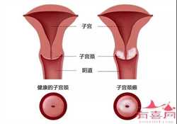 郑州私人试管代怀，郑州做输卵管检查需要多少钱